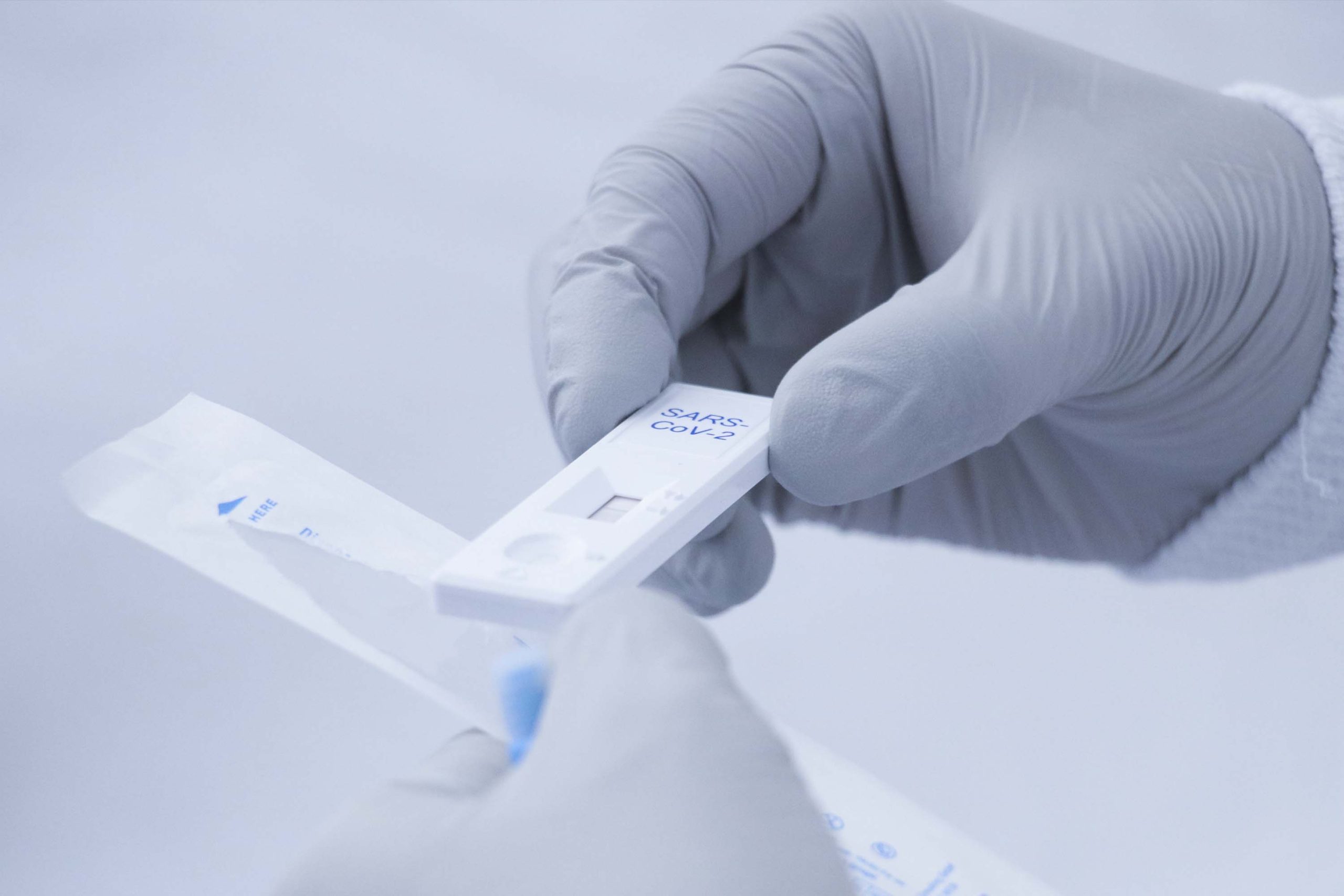 Baja el número de casos activos de COVID-19: Salud