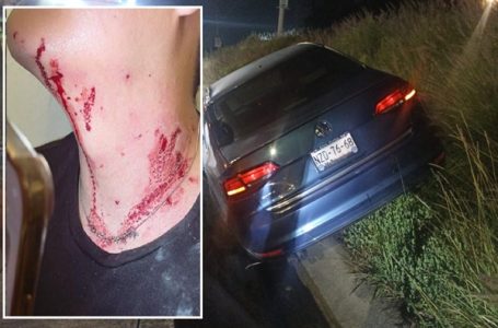 Lanzan piedras a conductor en Periférico Ecologico y queda lesionado